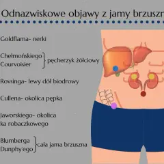 Objaw Blumberga, wskazujący na podrażnienie otrzewnej w całej jamie brzusznej, jest jednym z objawów omawianych na ilustracji.