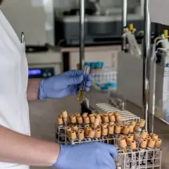 Laborantka w niebieskich rękawiczkach analizuje próbkę, która może zawierać informacje o poziomie dehydrogenazy mleczanowej.