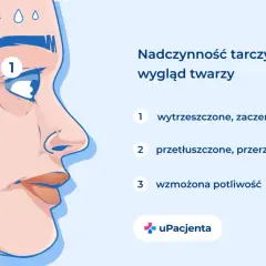 Nadczynność tarczycy objawy: wytrzeszczone oczy (1), przetłuszczone włosy (2) i wzmożona potliwość (3) na twarzy.