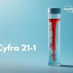 Cyfra 21-1: czerwona ciecz wiruje w probówce, tworząc pęcherzyki. Logo NeoMedica Centrum Medyczne.