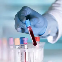 Ręka w niebieskiej rękawiczce trzyma probówkę z krwią. Badanie lipoproteiny a co to jest, kluczowe dla zdrowia serca.