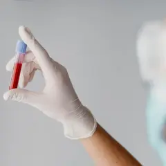 Ręka w białej rękawiczce trzyma probówkę z krwią. Wynik badania mchc jest kluczowy.