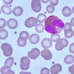 Granulocyt obojętnochłonny, czyli eo, wśród licznych erytrocytów.