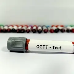 Probówki z krwią do badania OGTT. W tle rzędy innych próbek.