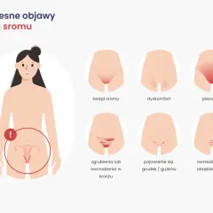 Ilustracja pokazuje wczesne objawy raka sromu: świąd, pieczenie, dyskomfort, owrzodzenia i grudki.