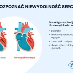 Ilustracja porównuje zdrowe serce z niewydolnym, wymieniając objawy niewydolności krążenia: duszności, obrzęki.