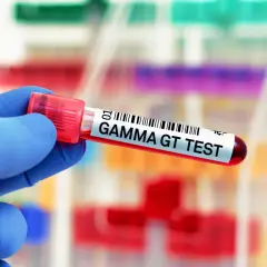 Rękawiczka w niebieskiej rękawicy trzyma probówkę z napisem "GAMMA GT TEST". Wynik badania jest w normie.
