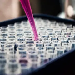 Różowa pipeta pobiera próbkę do jednego z wielu przezroczystych naczyń w laboratorium. To praca, która może pomóc patomorfologowi w diagnozie.