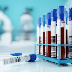 Próbówki z krwią w stojaku, gotowe do analizy. W tle mikroskopy, sugerujące badania laboratoryjne, być może w kierunku odczyn biernackiego.