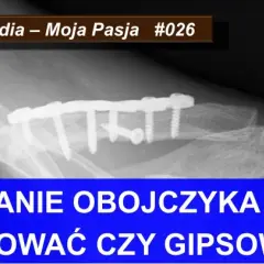 Ile trwa rehabilitacja po złamaniu obojczyka i co warto wiedzieć?
