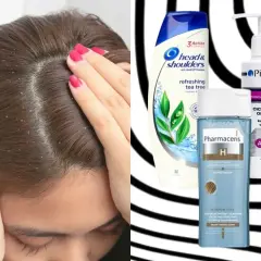 Kobieta z łupieżem na głowie. Obok szampony Head & Shoulders, Pirolam i Pharmaceris – co na łupież.