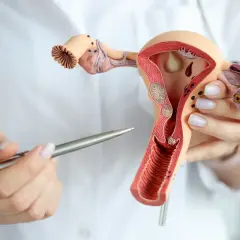 Model narządu rodnego kobiety z widocznymi zmianami, które mogą sugerować raka endometrium. Lekarz wskazuje na nie długopisem.