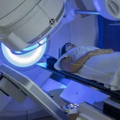 Pacjentka leży na stole terapeutycznym pod aparatem do radioterapii. Zielone linie laserowe wyznaczają pole napromieniania. To przykład, jak wygląda radioterapia co to za leczenie.