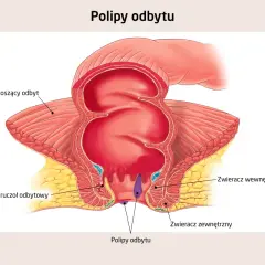 Anatomia odbytu z widocznymi polipami. Ilustracja pokazuje mięsień dźwigacz odbytu, gruczoły odbytu, zwieracze wewnętrzny i zewnętrzny oraz polipy odbytu.