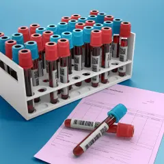 Rząd probówek z krwią, niektóre z czerwonymi, inne z niebieskimi nakrętkami, stoją w białym stojaku. Obok leży różowa faktura ABC Healthcare. Ca 15-3.
