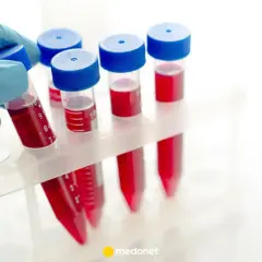 Ręka w niebieskiej rękawiczce pobiera probówkę z krwią do badań, w tym do wykonania odczynu Coombsa.
