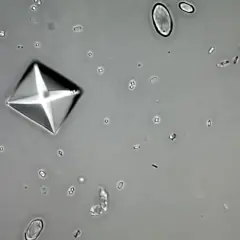 Pod mikroskopem widoczne są szczawiany wapnia w moczu, tworzące charakterystyczne kryształy w kształcie koperty.