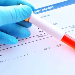 Ręka w niebieskiej rękawiczce trzyma probówkę z krwią nad raportem laboratoryjnym. Wynik testu ferrytyny to 62.3 ng/mL.