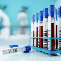 Próbówki z krwią w stojaku, gotowe do analizy. W tle mikroskopy, sugerujące badania laboratoryjne, być może w kierunku odczyn biernackiego.