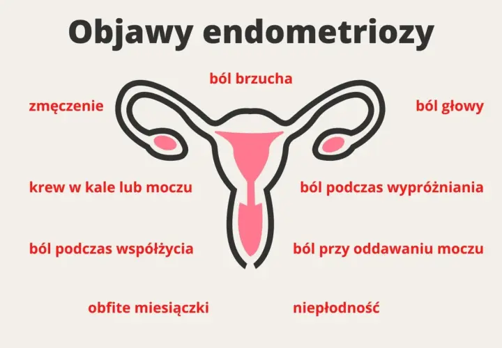 Objawy endometriozy: ból brzucha, zmęczenie, krew w kale/moczu, ból głowy, ból podczas współżycia, ból przy oddawaniu moczu, obfite miesiączki, niepłodność.