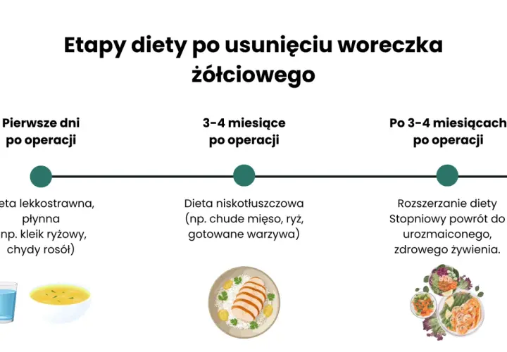 Jadłospis tygodniowy po usunięciu woreczka żółciowego: etapy diety - lekkostrawna, niskotłuszczowa, rozszerzona.