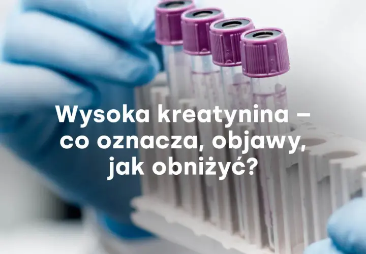 Rękawiczka laboratoryjna trzyma probówki. Tekst: "Wysoka kreatynina – co oznacza, objawy, jak obniżyć?".