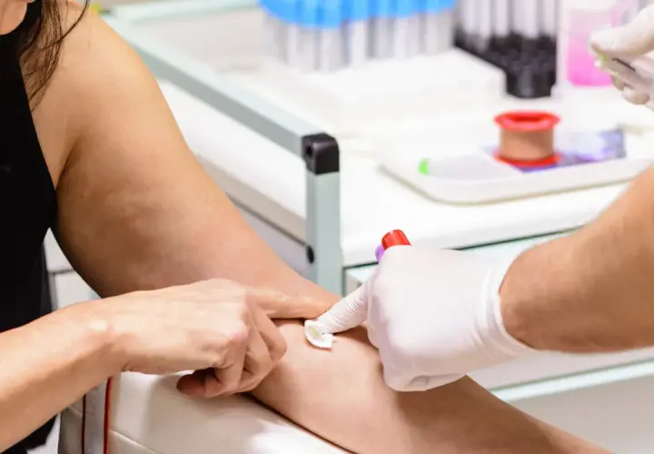 Pobieranie krwi do badań. Ręka pacjentki z widoczną żyłą, pielęgniarka w rękawiczce przygotowuje miejsce wkłucia. W tle probówki i sprzęt laboratoryjny.