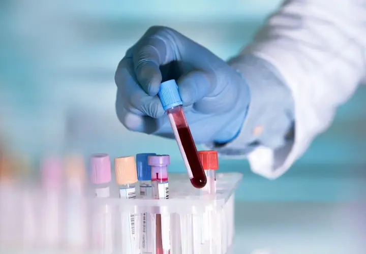 Ręka w niebieskiej rękawiczce trzyma probówkę z krwią. Badanie lipoproteiny a co to jest, kluczowe dla zdrowia serca.