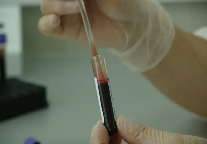 Rękawiczki ochronne i pipeta z krwią w probówce. P-lcr - analiza laboratoryjna.