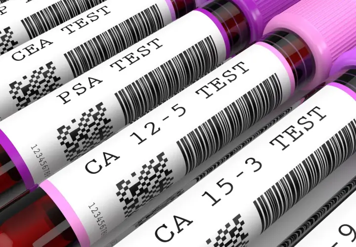 Zestaw badań markery nowotworowe: CEA, PSA, CA 12-5, CA 15-3. Sprawdź pakiet cena.