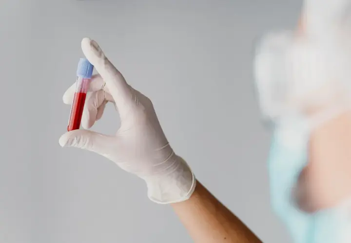 Ręka w białej rękawiczce trzyma probówkę z krwią. Wynik badania mchc jest kluczowy.