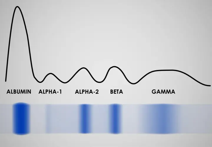 Wykres proteinogramu z frakcjami: albuminy, alfa-1, alfa-2, beta i gamma.
