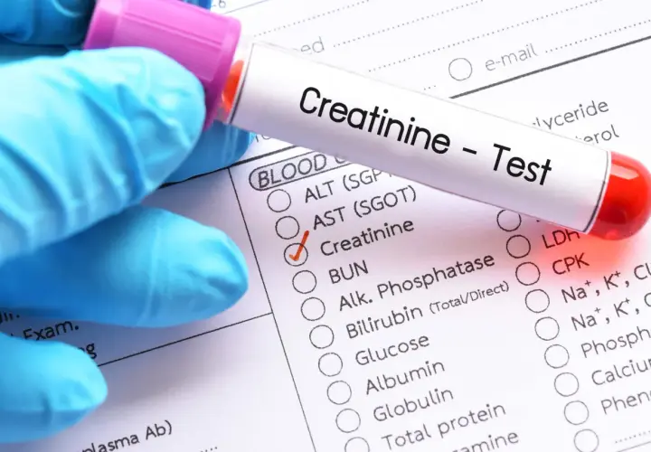 Rękawiczka w niebieskiej rękawiczce trzyma probówkę z napisem "Creatinine - Test". Obok zaznaczono opcję "Creatinine", sugerując badanie poziomu kreatyniny w normie.