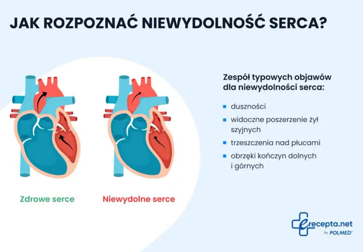 Ilustracja porównuje zdrowe serce z niewydolnym, wymieniając objawy niewydolności krążenia: duszności, obrzęki.