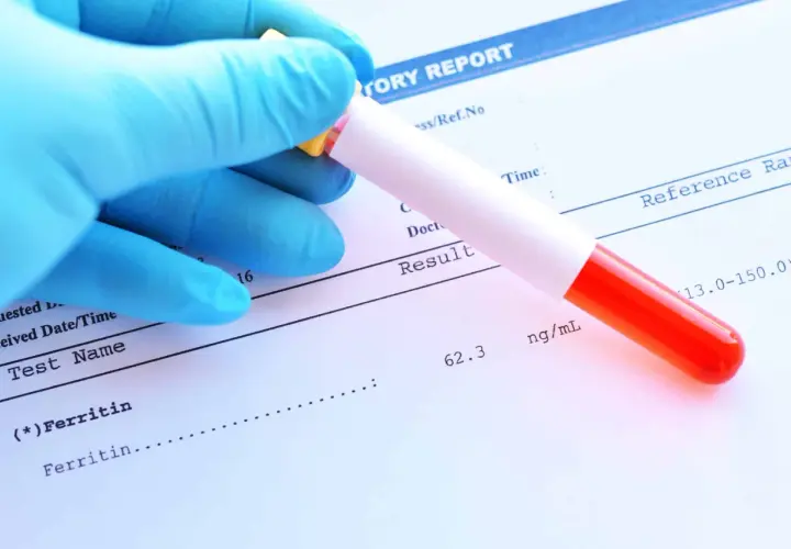 Ręka w niebieskiej rękawiczce trzyma probówkę z krwią nad raportem laboratoryjnym. Wynik testu ferrytyny to 62.3 ng/mL.