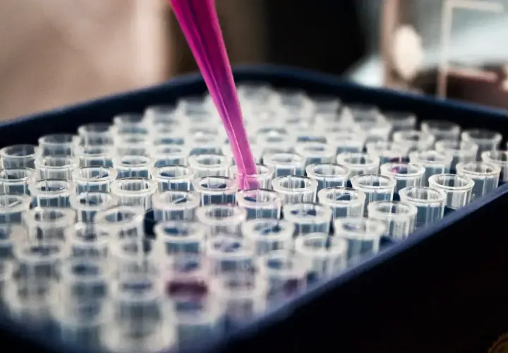 Różowa pipeta pobiera próbkę do jednego z wielu przezroczystych naczyń w laboratorium. To praca, która może pomóc patomorfologowi w diagnozie.