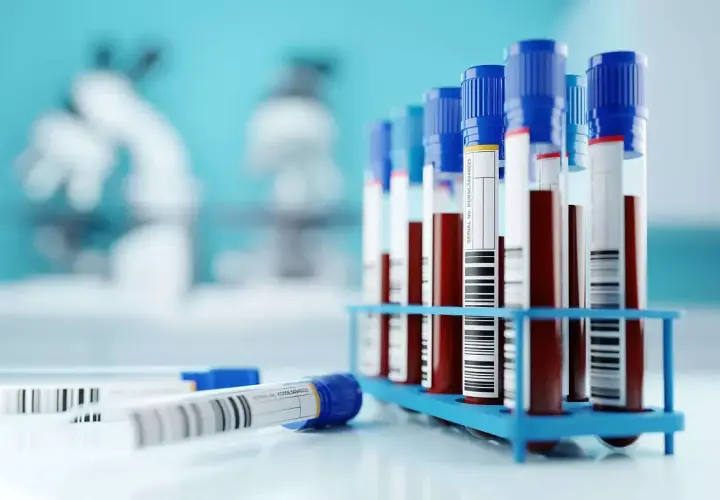 Próbówki z krwią w stojaku, gotowe do analizy. W tle mikroskopy, sugerujące badania laboratoryjne, być może w kierunku odczyn biernackiego.