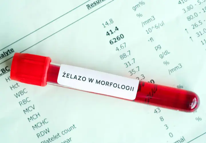 Czerwona probówka z krwią na tle wyników badań laboratoryjnych. Etykieta na probówce informuje o badaniu "ŻELAZO W MORFOLOGII".