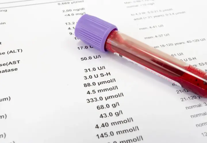 Probówka z krwią na tle wyników badań. Jonogram i inne parametry medyczne widoczne na papierze.