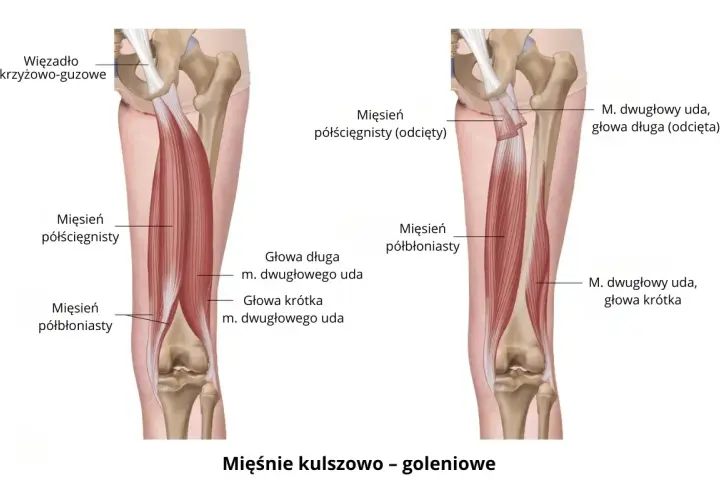 Anatomia mięśni tylnej części uda: mięsień półścięgnisty i półbłoniasty.