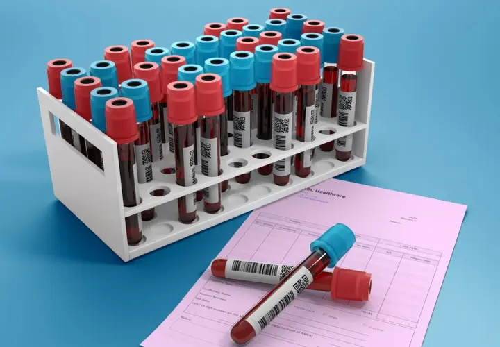 Rząd probówek z krwią, niektóre z czerwonymi, inne z niebieskimi nakrętkami, stoją w białym stojaku. Obok leży różowa faktura ABC Healthcare. Ca 15-3.