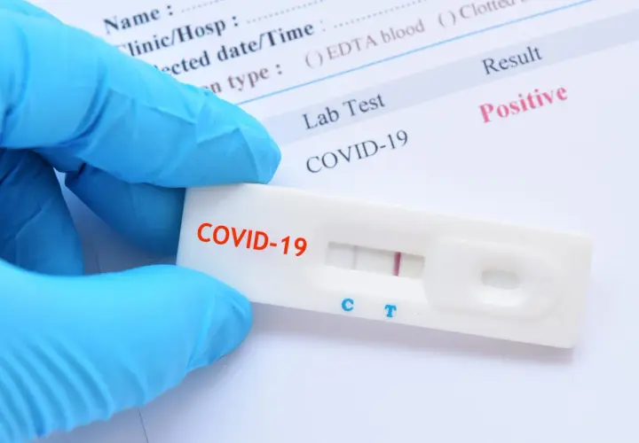 Rękawiczka w niebieskiej rękawiczce trzyma test na COVID-19 z pozytywnym wynikiem. Zastanawiasz się, ile kosztuje test na COVID?