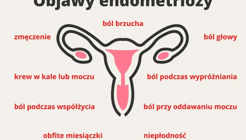 Objawy endometriozy: ból brzucha, zmęczenie, krew w kale/moczu, ból głowy, ból podczas współżycia, ból przy oddawaniu moczu, obfite miesiączki, niepłodność.