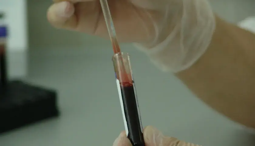Rękawiczki ochronne i pipeta z krwią w probówce. P-lcr - analiza laboratoryjna.
