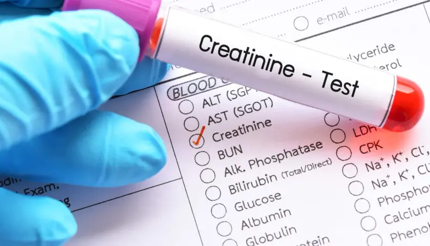 Rękawiczka w niebieskiej rękawiczce trzyma probówkę z napisem "Creatinine - Test". Obok zaznaczono opcję "Creatinine", sugerując badanie poziomu kreatyniny w normie.