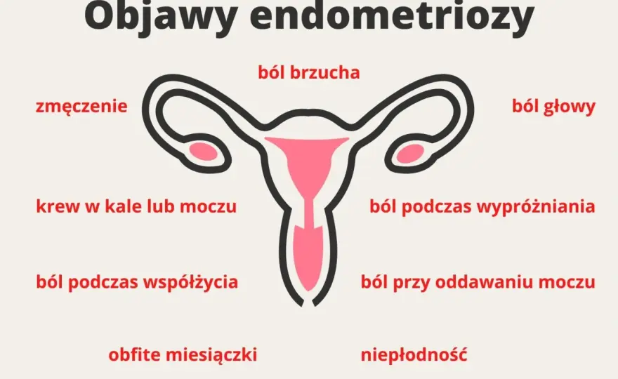 Endometrioza - jak rozpoznać objawy, zanim ból przejmie codzienność