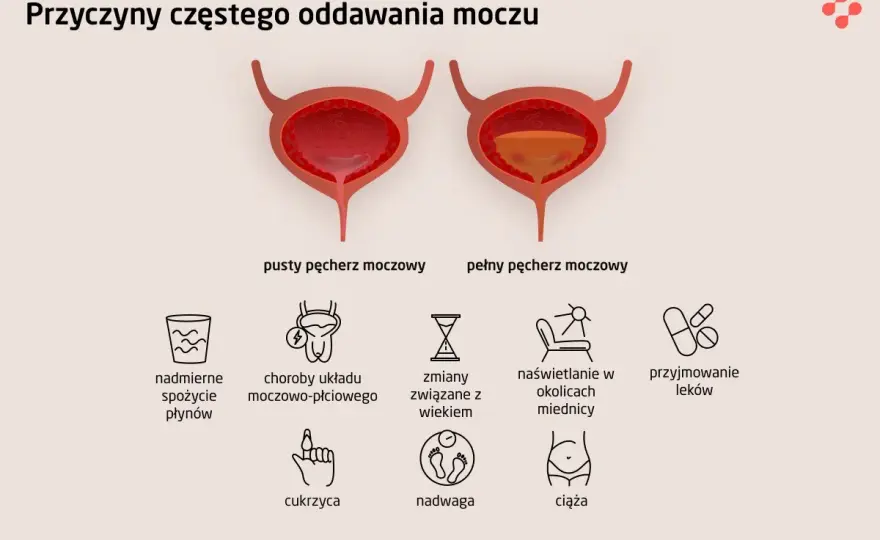 Częstomocz - Przyczyny, badania, i kiedy iść do lekarza?