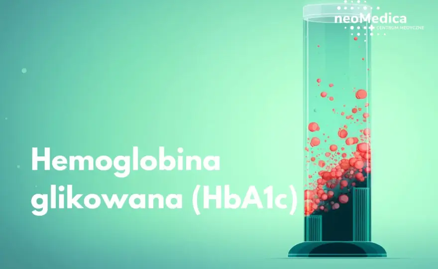 Hemoglobina glikowana - jak czytać wynik i dbać o stopy?