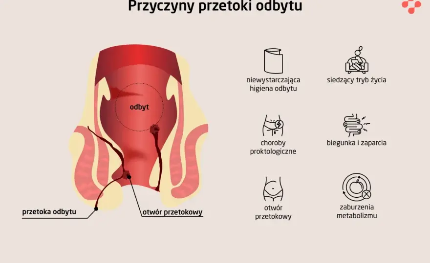 Przetoka odbytu - Jakie badania są naprawdę potrzebne?