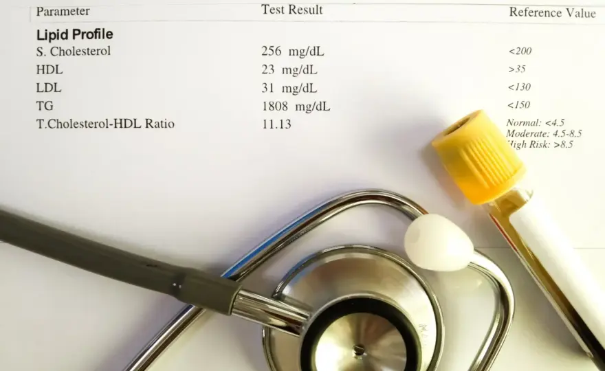 Lipidogram - cena, przygotowanie i darmowe badanie?